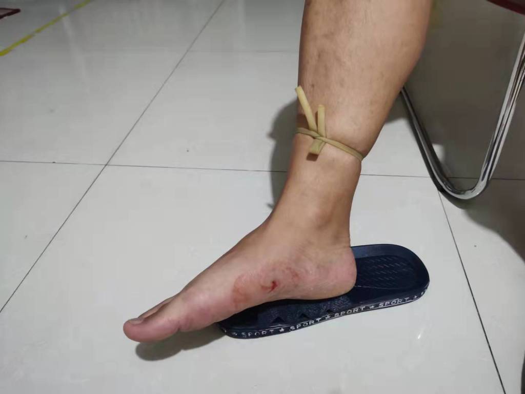 紧急救援